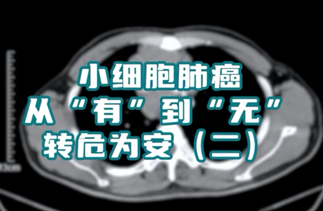 小細(xì)胞肺癌患者，縱隔淋巴結(jié)腫大，情況危急。通過(guò)介入綜合治療，病灶已基本消失